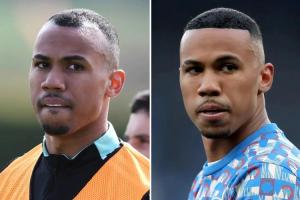 32歲扎卡植發(fā)！前隊(duì)友加布25歲時便進(jìn)行植發(fā)，現(xiàn)在看來效果不錯