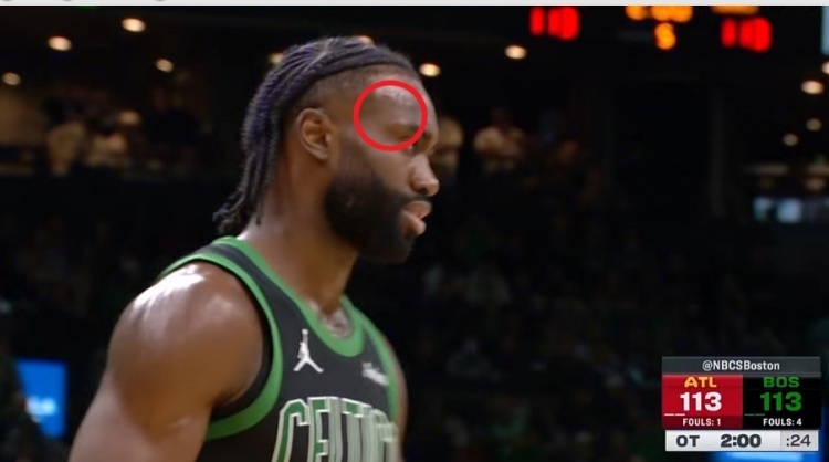 嚇人！杰倫-布朗平摔頭部著地??眉毛旁邊鼓了個大包還留在場上